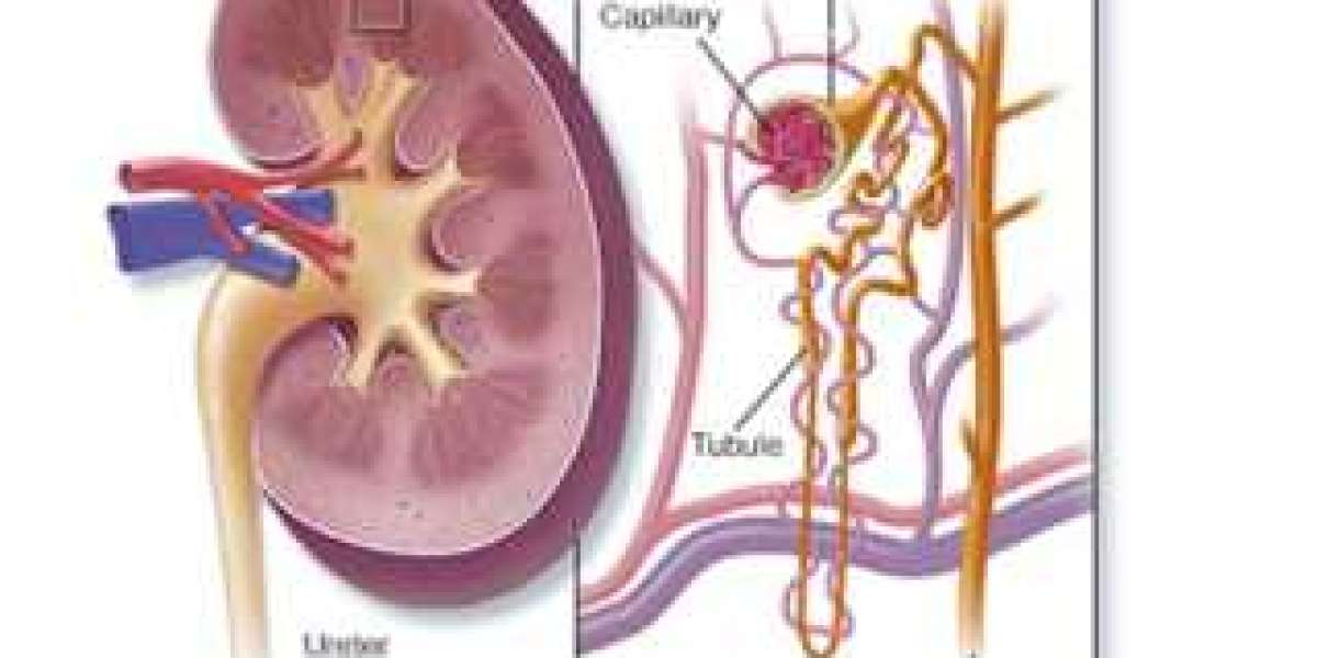 How To Treat Acute Kidney Injury?