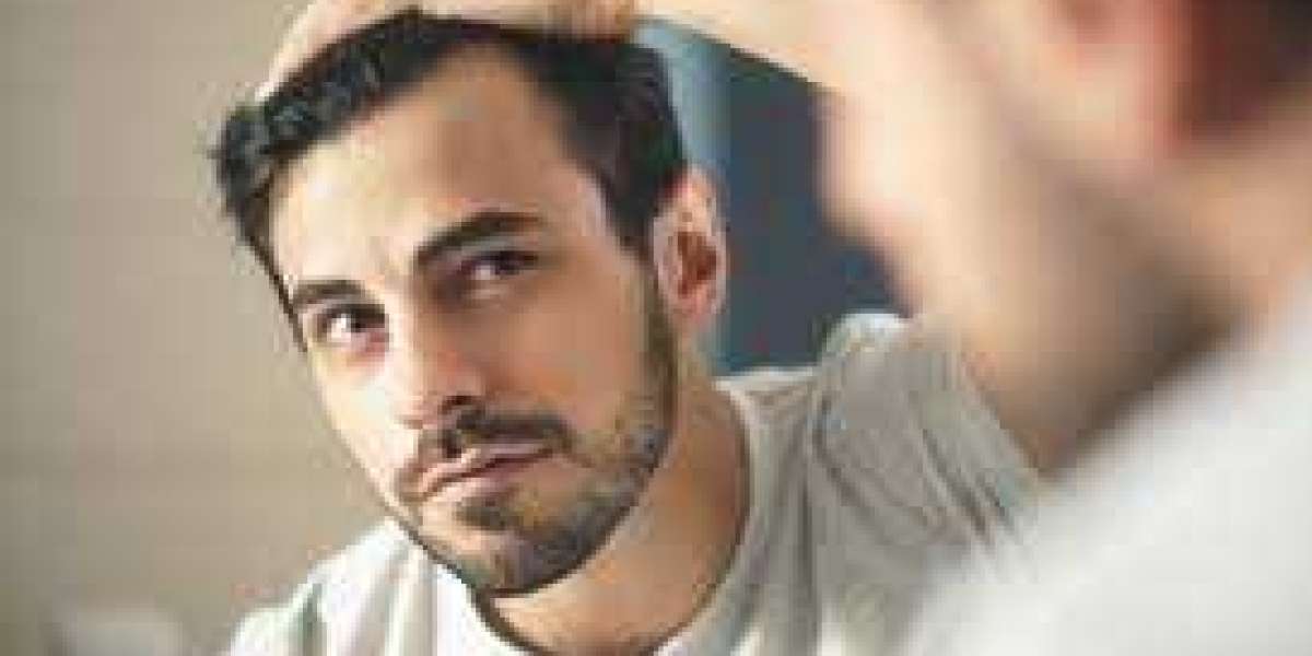 What Happens 15 Days After a Hair Transplant?