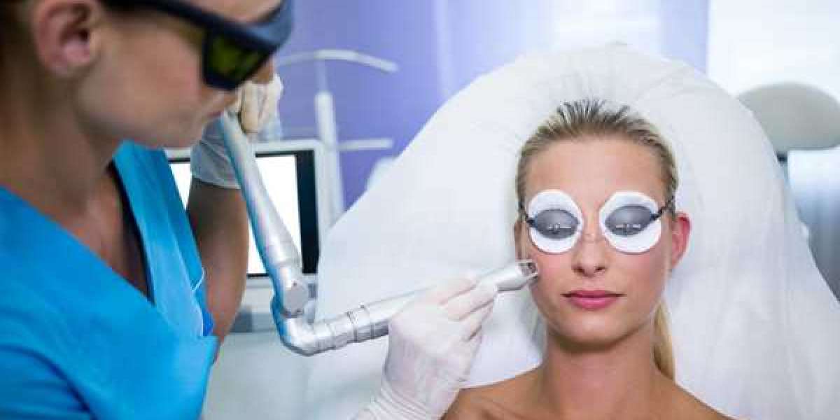 How To Get Red-Carpet-Ready with Laser Treatment?