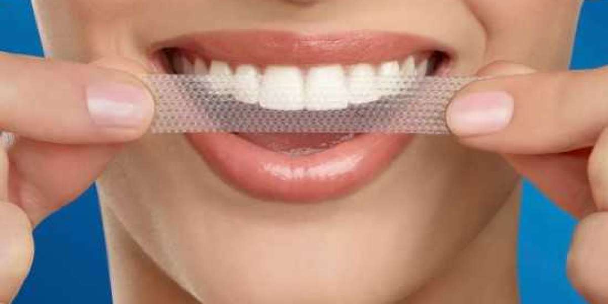 Get Ready to Shine: How Crest Tooth Whitening Strips Transform Smiles!